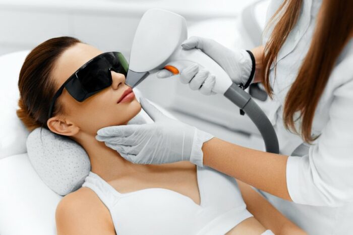 épilation laser