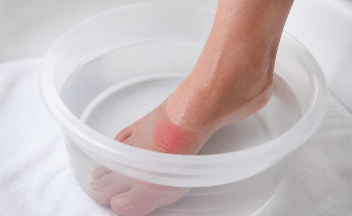 découvrez les bienfaits et précautions du bain de pied à l'eau de javel pour traiter une infection. apprenez comment l'utiliser en toute sécurité et efficacement.