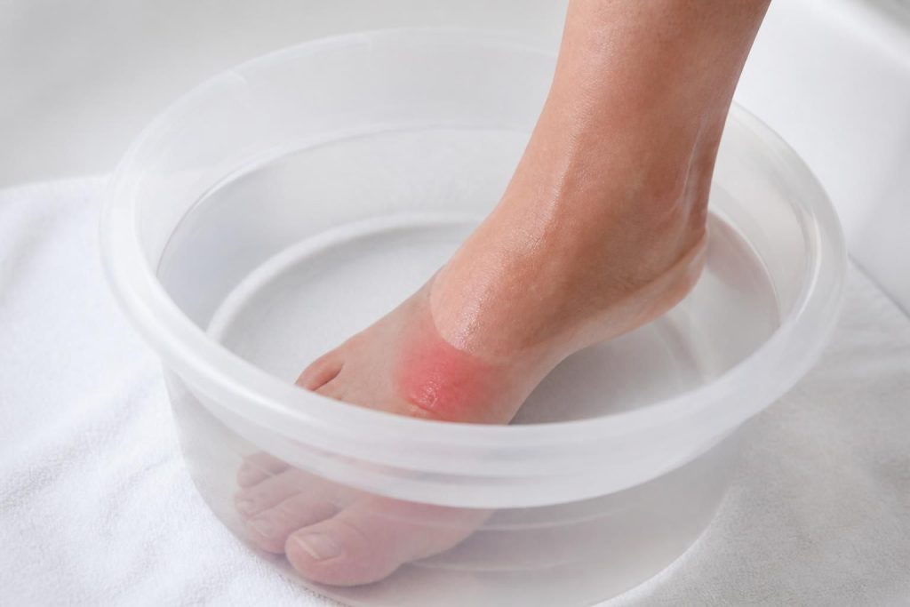 découvrez les bienfaits et précautions du bain de pied à l'eau de javel pour traiter une infection. apprenez comment l'utiliser en toute sécurité et efficacement.