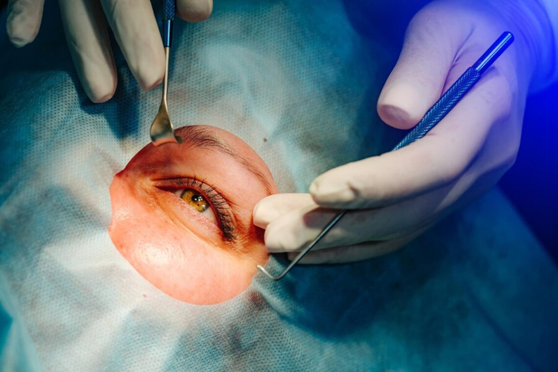 Blépharoplastie