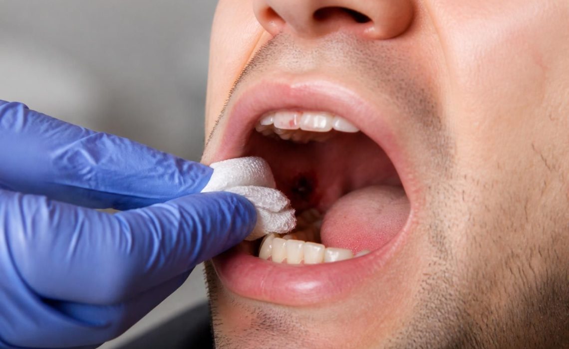 découvrez les premiers secours essentiels et des conseils pratiques en cas de présence de boules de sang dans la bouche pour agir rapidement et efficacement.