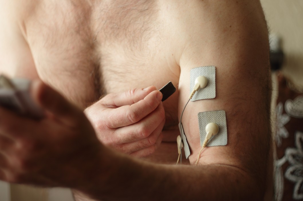 Electrostimulation