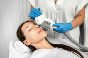 résultat épilation laser