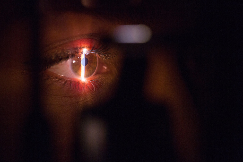 chirurgie des yeux