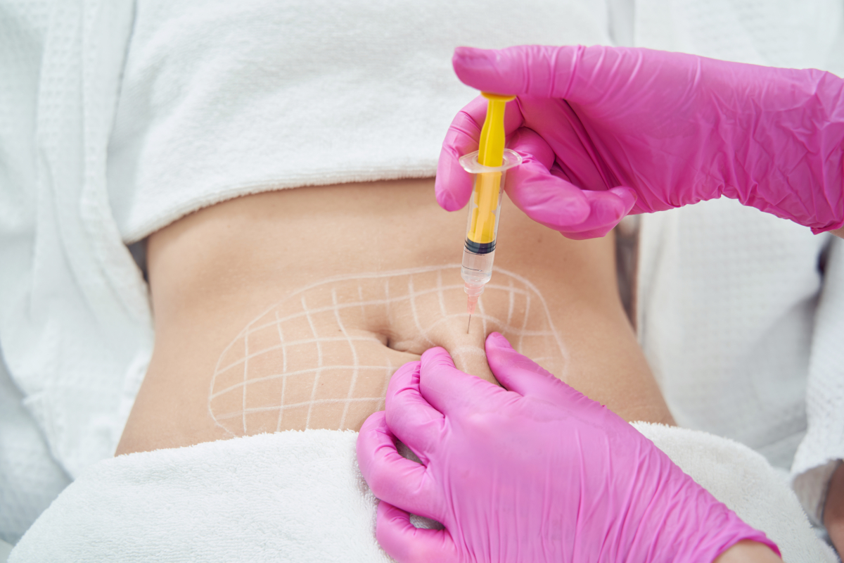 chirurgie esthétique