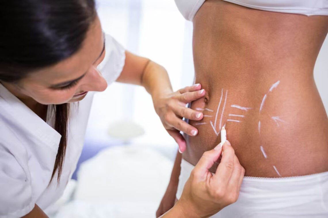 chirurgie esthétique