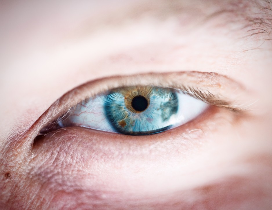 cornée oeil