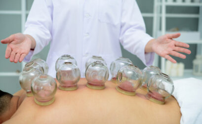 cupping therapy