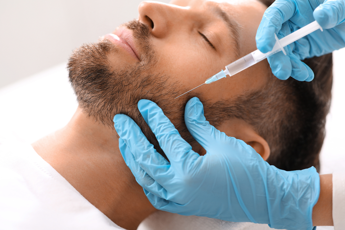 faire greffe barbe