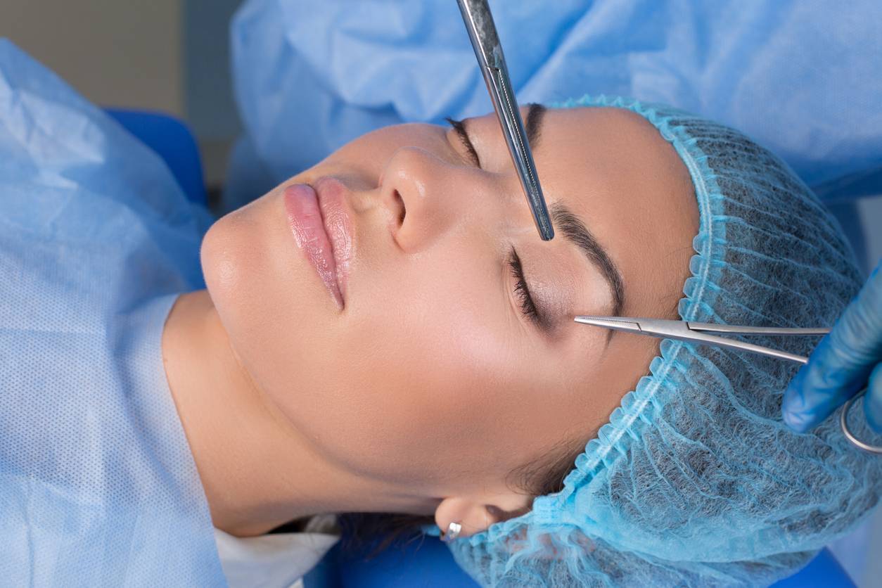 blépharoplastie, chirurgie anti-âge