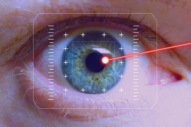 Chirurgie lazer des yeux"Lasik"