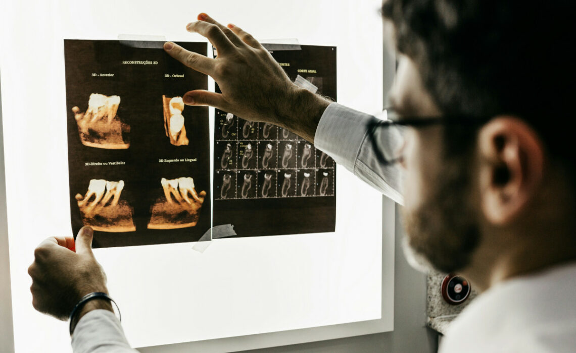 radiographie dentaire