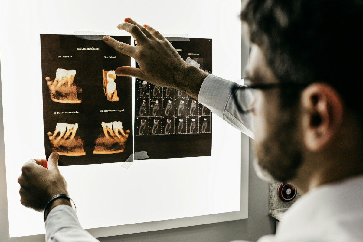 radiographie dentaire