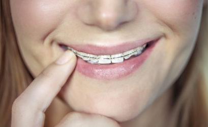 traitement orthodontique adulte