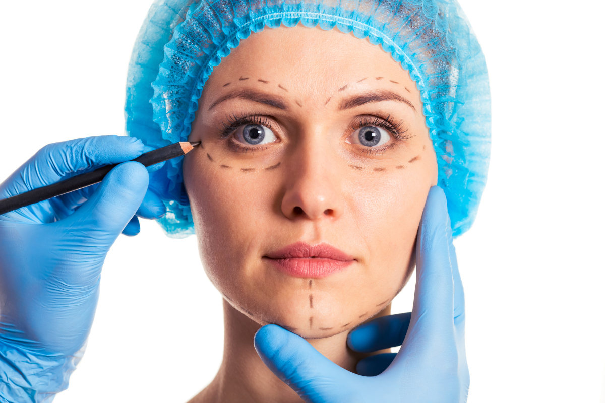 Blépharoplastie